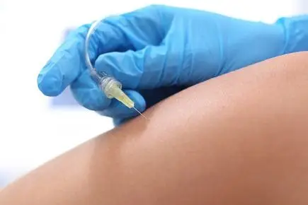 Karboksyterapia na cellulit RosaMed Clinic