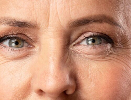 Zmarszczki pod oczami – przyczyny i metody redukcji