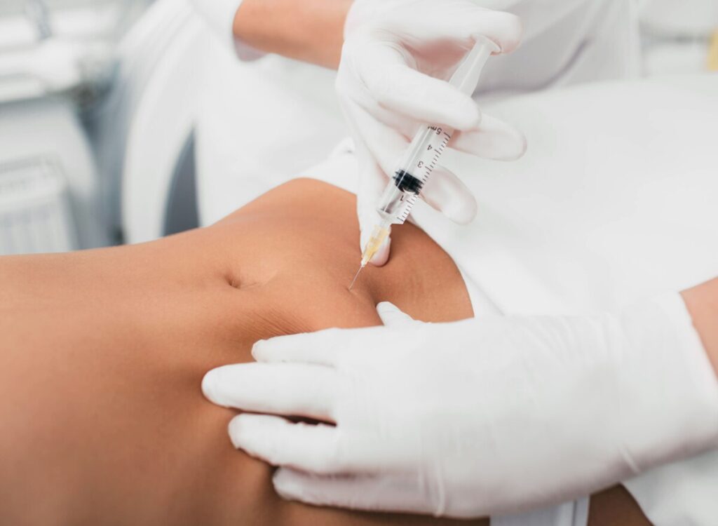 Mezoterapia wykonywana na brzuchu - sprawdź jak wygląda zabieg mezoterapii igłowej na ciało - RosaMed Clinic Warszawa