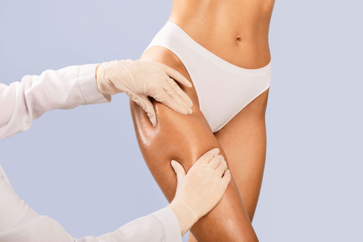 Lekarz medycyny estetycznej sprawdzający cellulit na udach - RosaMed Clinic Warszawa