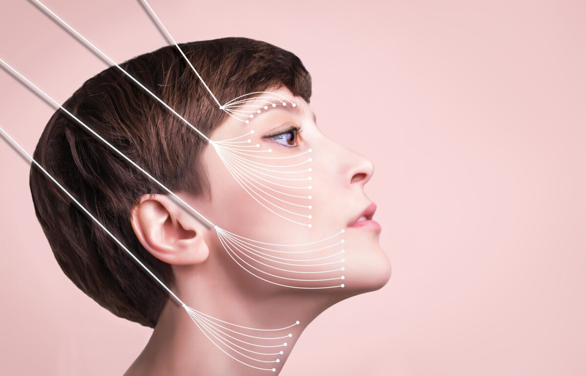 Kobieta z rysunkiem prezentującym rozkład nici haczykowych na twarzy - dowiedz się więcej jak działają