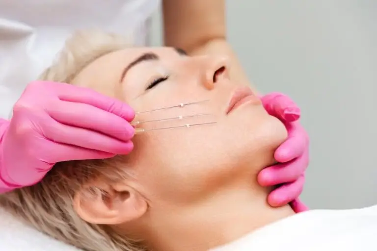 Ujedrniajace nici PDO | Rosamed Clinic